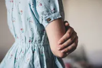 Behandlungen bei Hautirritationen wie Fisteln bei Ihrem Profi – der Akneambulanz.
